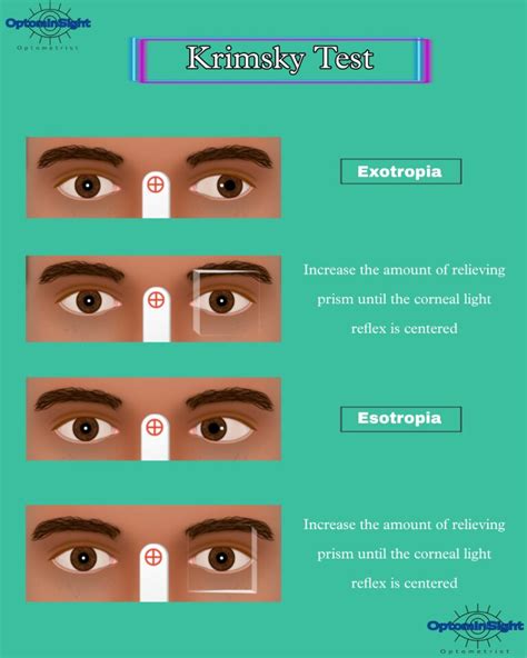 corneal reflex test results|Corneal Reflex Test .